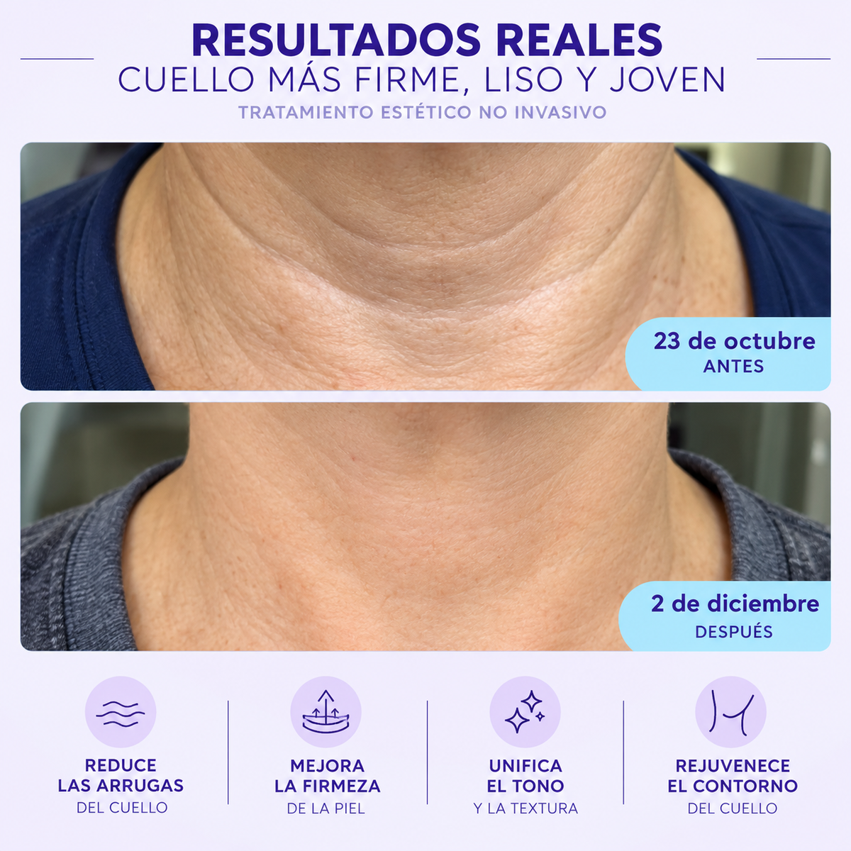 GOPURE Tighten & Lift Neck Cream