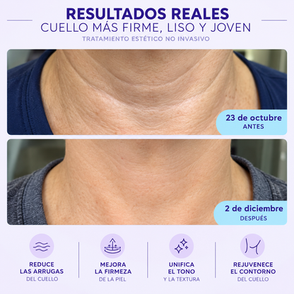 GOPURE Tighten & Lift Neck Cream